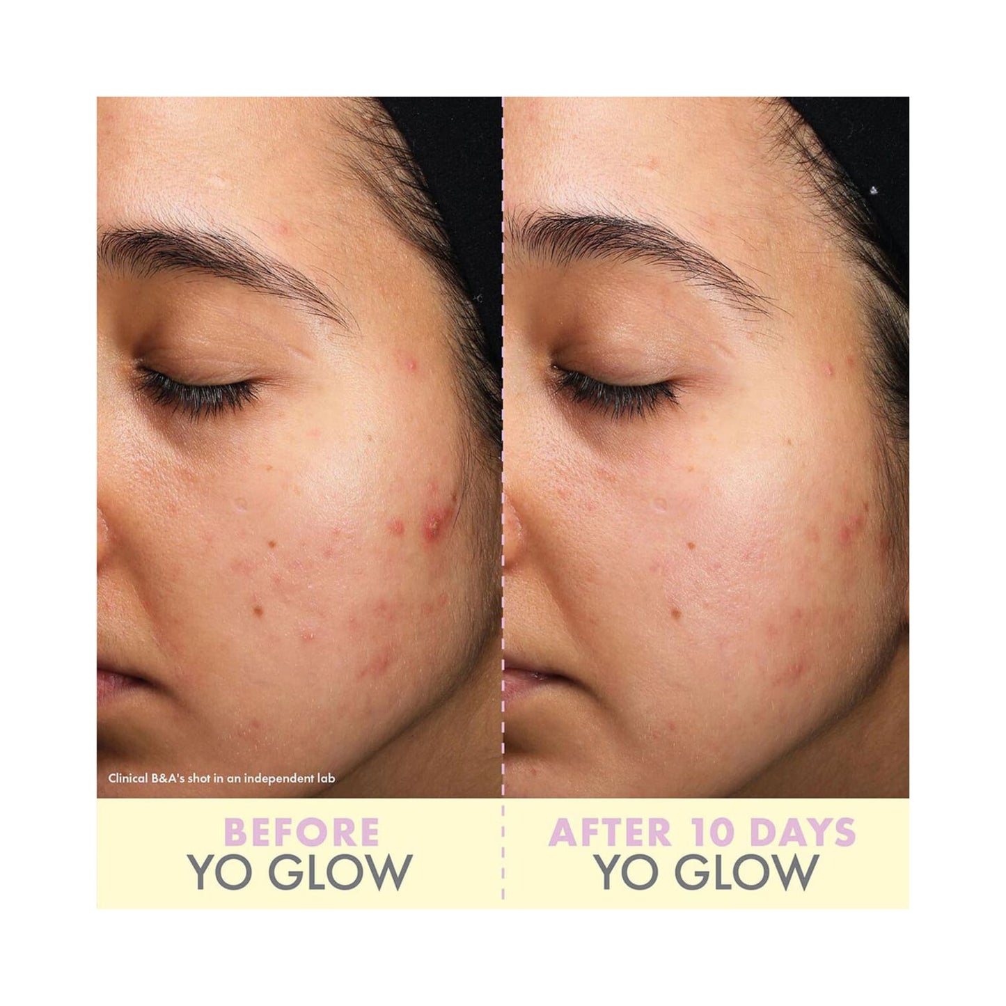 Wishful Yo Glow AHA & BHA Facial Enzyme Scrub (40ml)