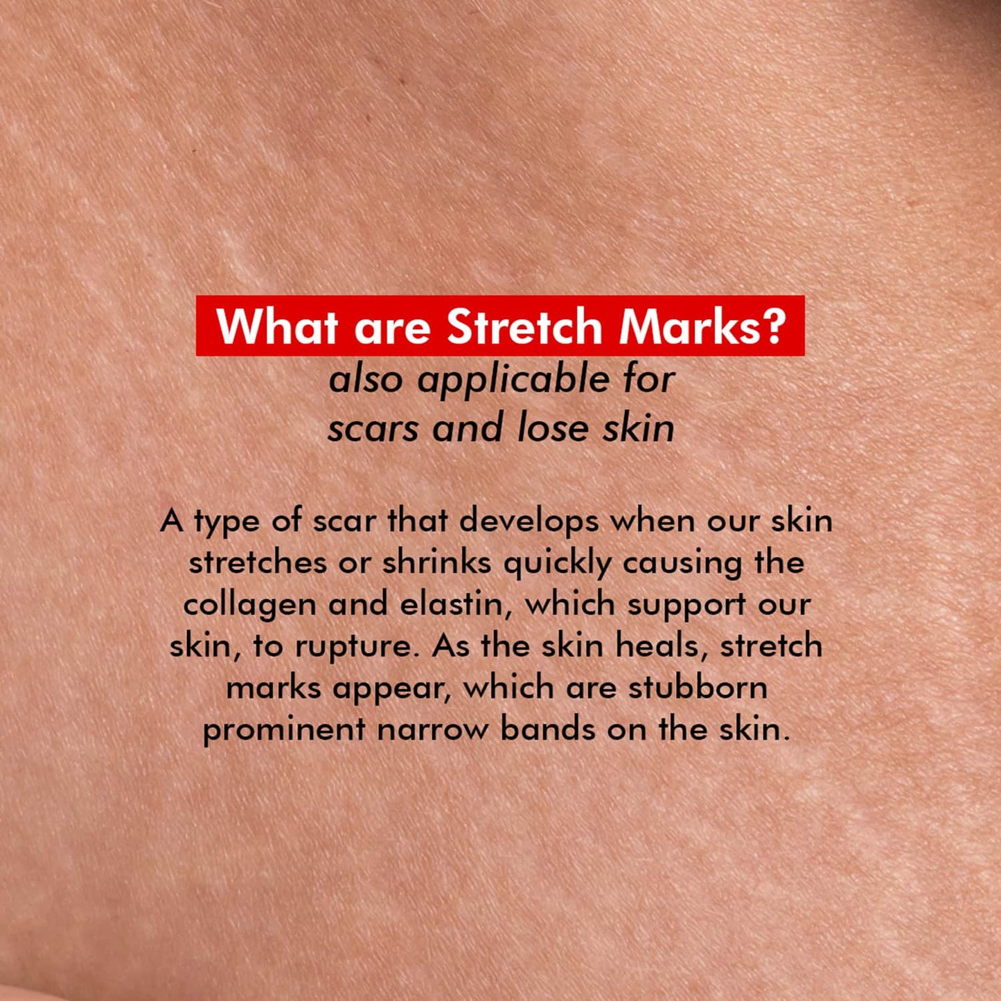 Conscious Chemist Retinol Body Cream For Stretch marks, Uneven Skin Tone & Scars - (100g)