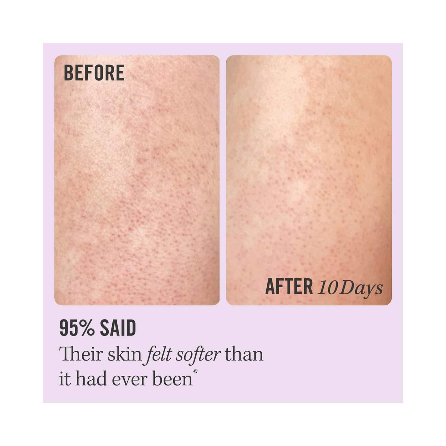 First Aid Beauty KP Bump Eraser Body Scrub With 10% AHA (56.7g)