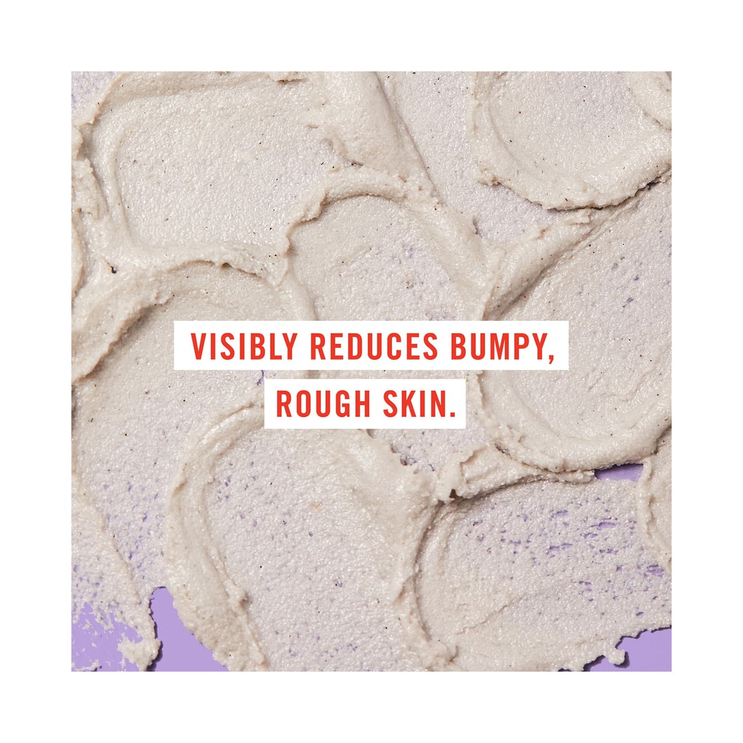 First Aid Beauty KP Bump Eraser Body Scrub With 10% AHA (226g)