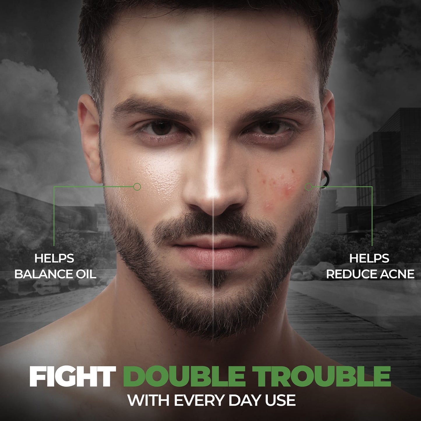 Beardo Acne Clear 2-In-1 Toning Serum (30ml)